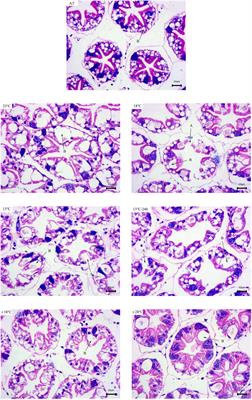 Physiological Responses of Pacific White Shrimp Litopenaeus vannamei to Temperature Fluctuation in Low-Salinity Water